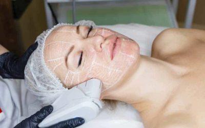 Czym właściwie jest Vivace RF i w jaki sposób działa