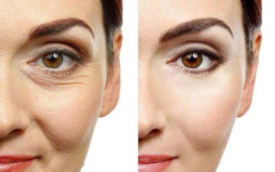 Zabiegi medycyny estetycznej po 40-ce