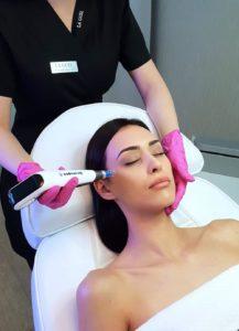 Mezoterapia mikroigłowa - Dermapen w Klinice La Guèl Warszawa