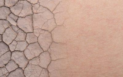 Twoja skóra traci jędrność? Sprawdź dlaczego