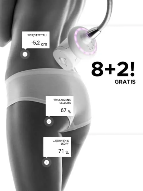 LA GUÈL – LPG Alliance 2 – Pakiet zabiegów LPG Alliance® Endermologie na ciało | Teraz 8+2 w Prezencie!
