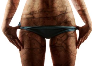 Z pomocą przychodzą zabiegi na suchą cerę!