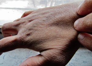 Stosuj nawilżające i natłuszczające kremy do rąk