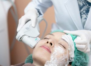 Czym jest i jak przebiega zabieg SonoQueen HIFU?