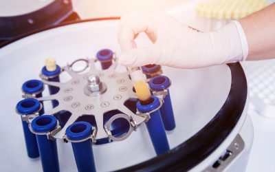 Osocze bogatopłytkowe – jak można je wykorzystać?