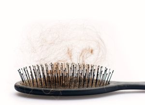 Środki stosowane miejscowo przy leczeniu łysienia androgenowego