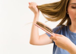 Przyczyny łysienia androgenowego u kobiet