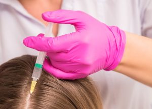 Jak wygląda diagnostyka - objawy łysienia androgenowego