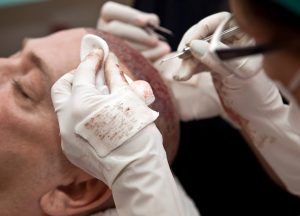 Leczenie farmakologiczne - jakie rozwiązania są wprowadzane?