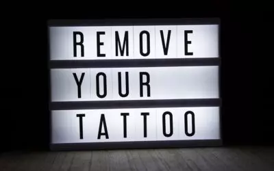 Laserowy zabieg usuwania tatuaży. Skuteczne i bezpieczne usunięcie tatuażu