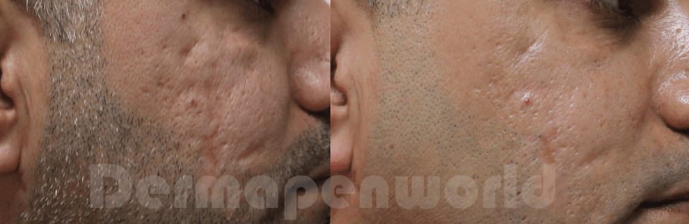 obraz 2022 09 29 150012001 Efekty zabiegów na twarz i ciało Przed i Po