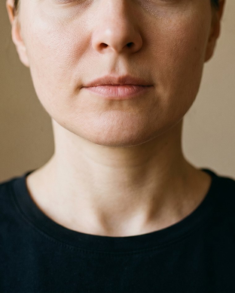 Dolna twarz po — smuklejszy, bardziej owalny kontur